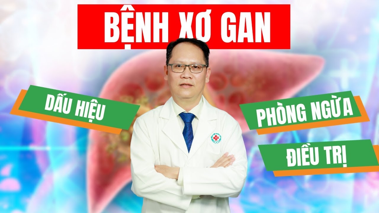 XƠ GAN: NGUYÊN NHÂN, TRIỆU CHỨNG CHẨN ĐOÁN VÀ ĐIỀU TRỊ BỆNH